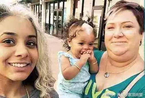 女性30岁白发是什么原因造成的,导致白发的原因