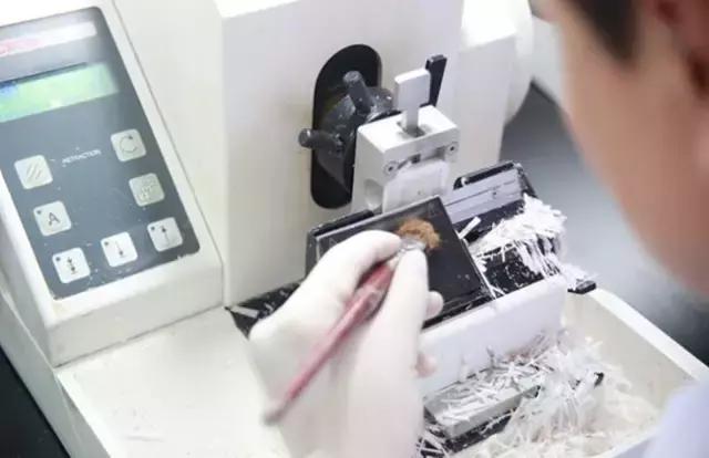 做胃镜怀疑癌变医生让做ct,做胃镜检查疑似肿瘤