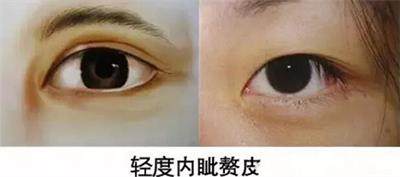 眼睛小怎么办单眼皮,眼睛小怎么办变大