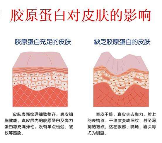 超声刀做完没效果怎么回事,超声没事还需要检查甲状腺功能吗