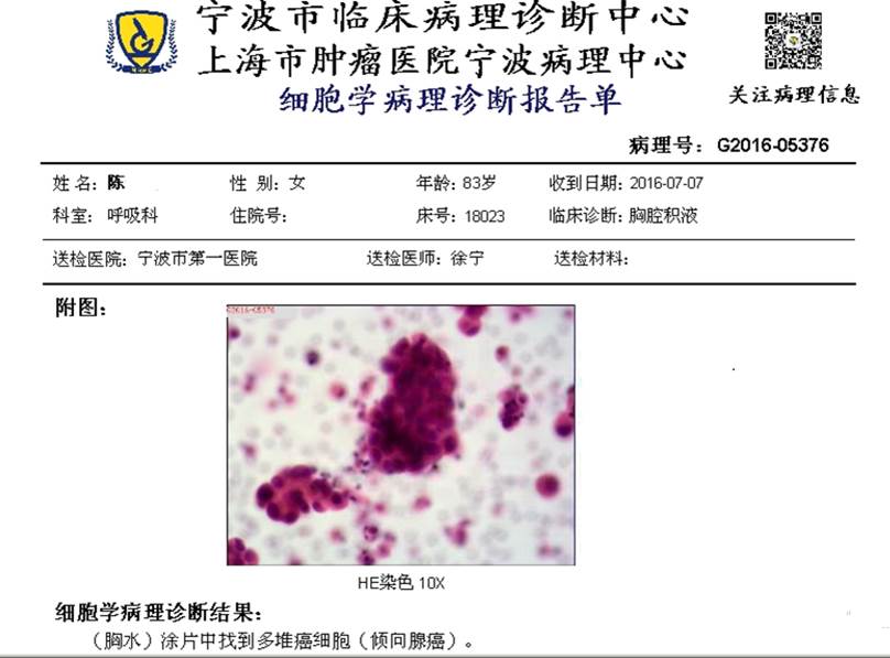 70岁老人抗肺癌自述,八旬老人抗击疫情感言