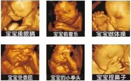 18周b超和四维彩超的区别,系统b超和四维彩超的区别