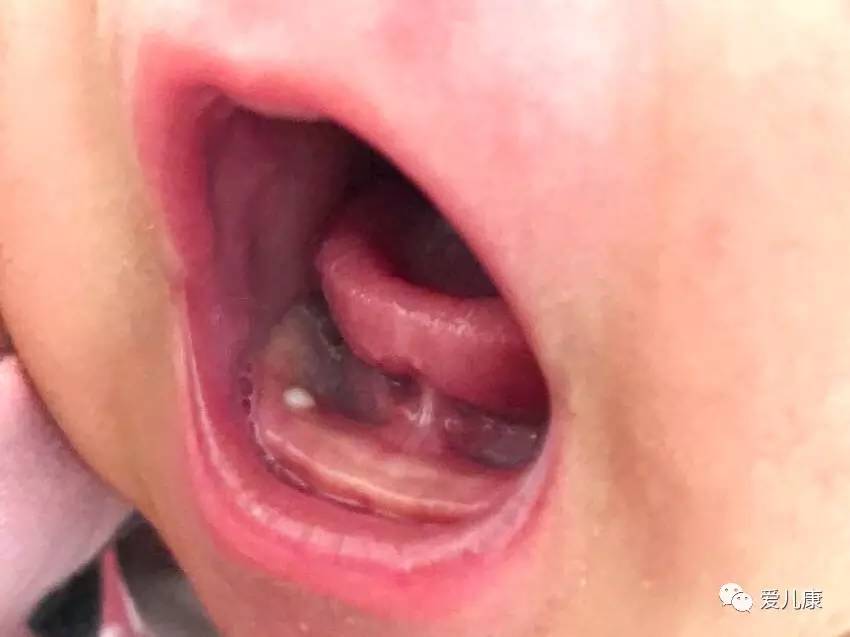 宝宝睡不踏实哭闹是不是吓到了,宝宝睡不安稳是大脑出问题了