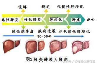 28岁小伙因为肝癌腹大如鼓，主任说太难治了！竟是这3点造成！