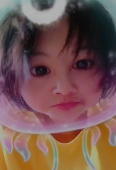 郑爽压力大深夜失眠嘴角上火，早晨起床头发凌乱不忘卖萌放飞自我