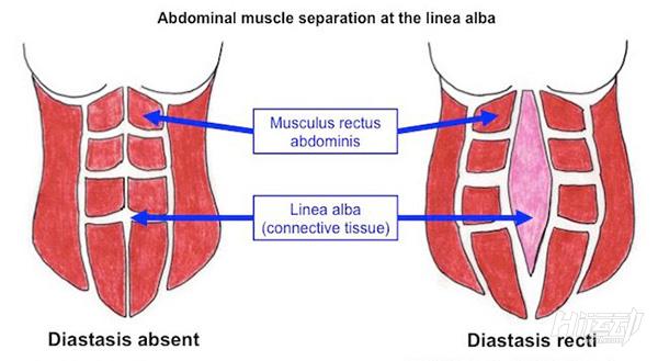 产后修复小腹最有效锻炼,产后小腹紧致训练