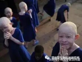 男人两鬓白发能恢复吗,紧张焦虑白发怎么恢复