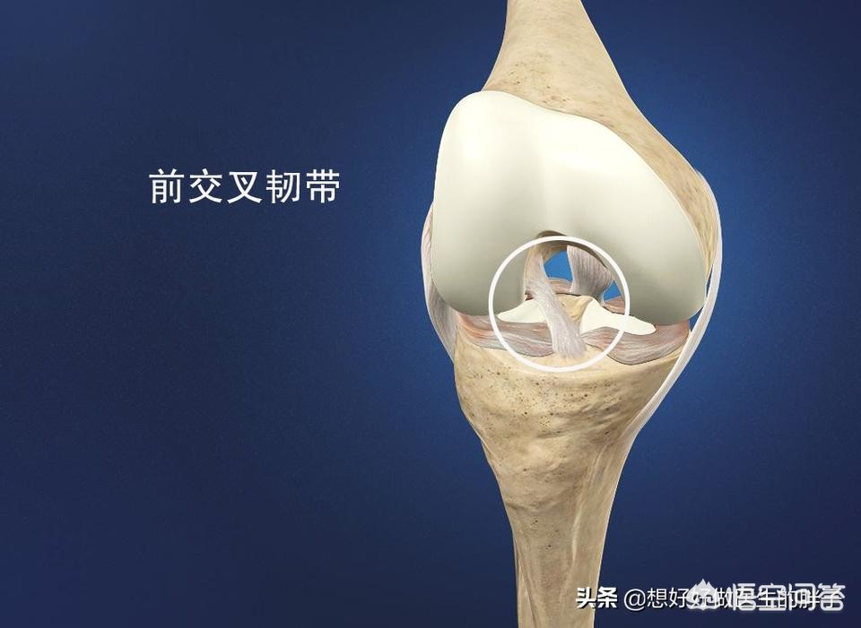 交叉韧带撕裂什么症状,交叉韧带撕裂怎么恢复正常