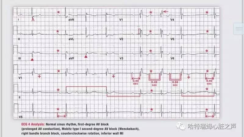 读心有术是什么意思,读心有术讲的是什么