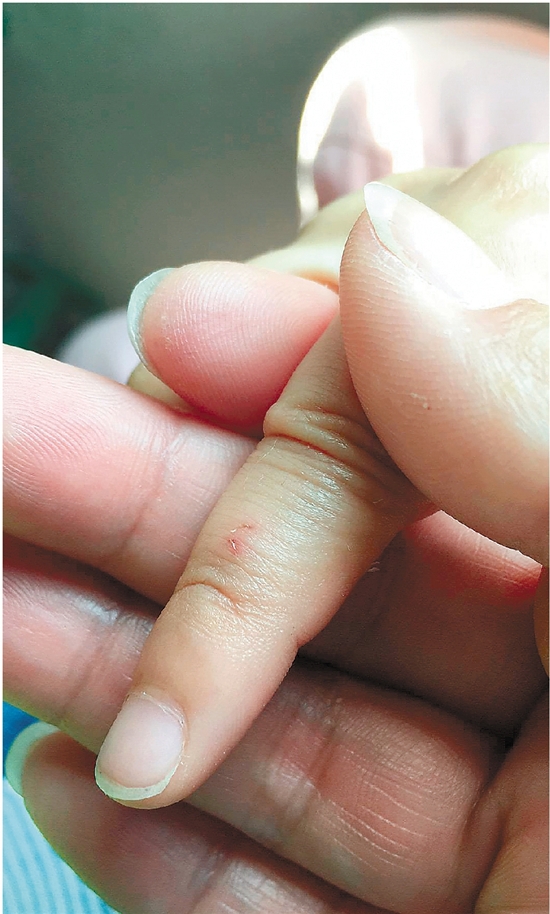 西湖边小松鼠咬伤喂食小游客这责任谁来负