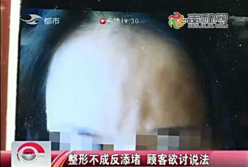 闀挎槬姝ｉ煩鍖荤枟缇庡鍖婚櫌,闀挎槬缇庡澶辫触