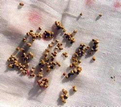 复发率高的最佳手术,复发后最佳挽救手术