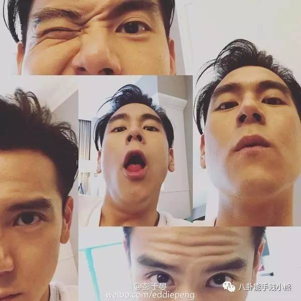 周冬雨鹿晗黄子韬的同款不对称下颌角，值得拥有吗？