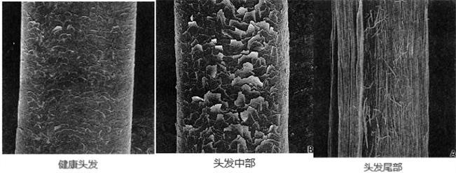 脱发男护理视频,脱发掉发护发秘籍