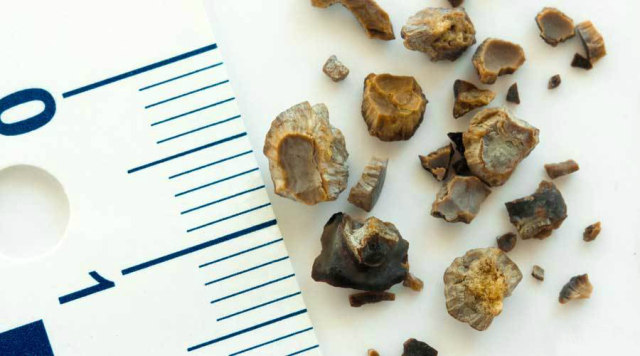 哪种疾病可以投保,男性疾病保险怎么投保