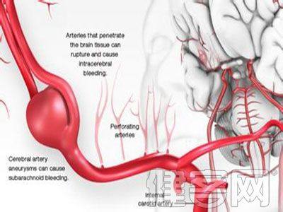 心绞痛缓解期间的五大药物治疗