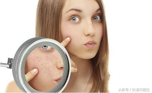 消除痘痘,消除暗疮印