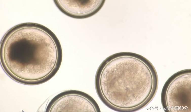 韩国杀菌后还有寄生虫吗 (进口食品中的寄生虫)