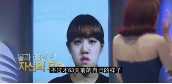 韩国整容手术恢复过程,韩国一个整容的综艺节目