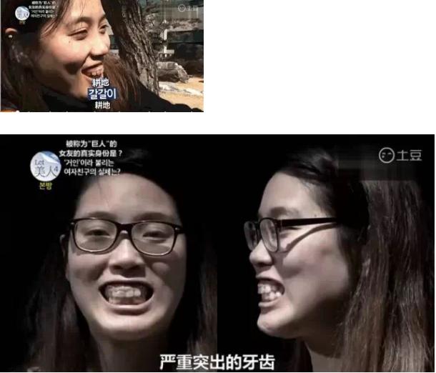 韩国整容手术恢复过程,韩国一个整容的综艺节目