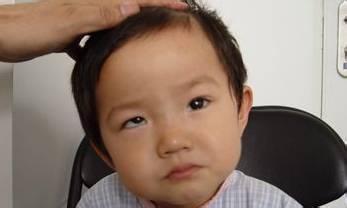 苏州斜视手术靠谱吗,苏州做激光近视手术