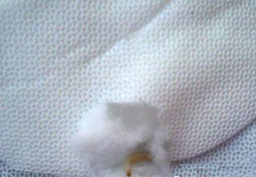 妇科主任居然用垃圾做卫生巾！