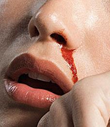 以食代药，把鼻腔流出来的血补回去