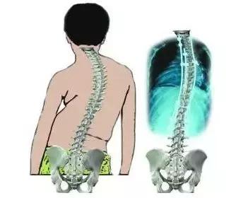 强直性脊柱炎看医生问什么,强直性脊柱炎一问一答