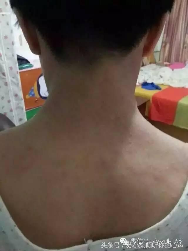 沙棘油，对皮肤还有如此神奇的效果