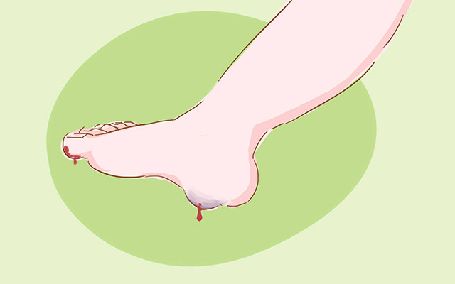 儿童凉鞋包脚好还是露脚趾的好,儿童凉鞋选鞋注意事项