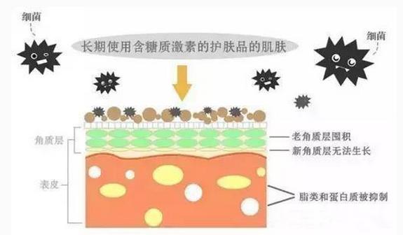 什么是激素脸症状怎么治疗,什么叫做激素脸有哪些症状