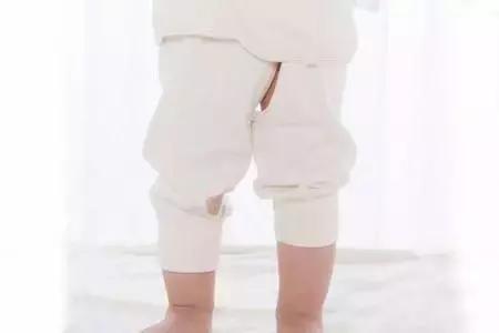 光屁股光脚丫，天热能给孩子大解放吗？