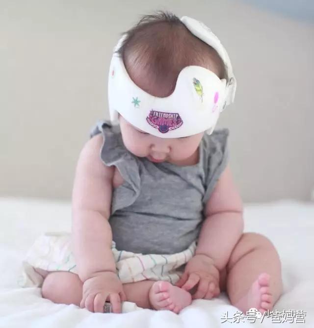 美国的宝宝扁头为什么要矫正,扁头在国外要做矫正吗