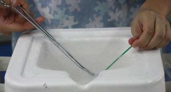 揭秘：人工取卵全过程看着都羞羞脸