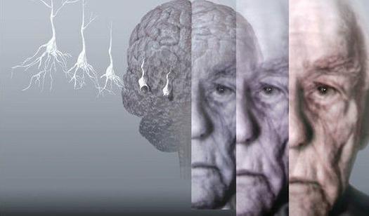 老年痴呆症10大前兆,老年痴呆前期症状是小脑萎缩吗