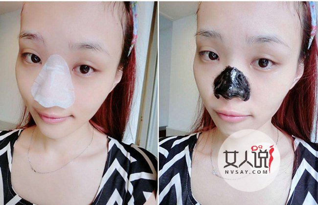 鼻子出油严重如何控油12岁,鼻翼两侧出油用什么控油