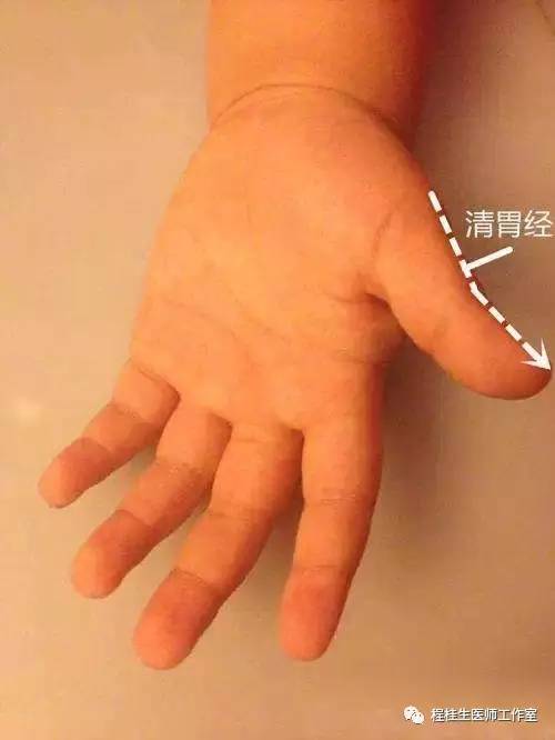 小宝宝脾胃虚弱积食便秘怎么调理,孩子积食脾胃差医生一招就搞定