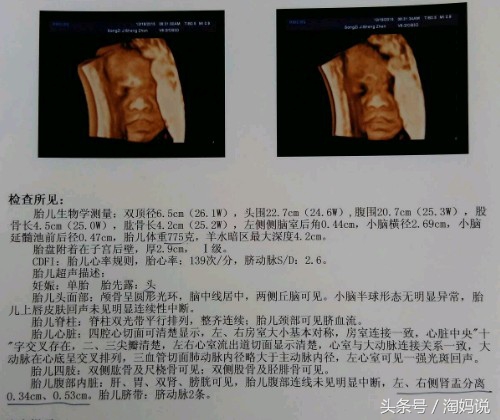 宝宝在妈妈肚子里踢膀胱怎么解决,怀孕期间胎儿总是踢膀胱漏尿