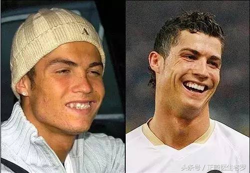 盘点整过牙的球星,还记得这些日益老去的球星吗