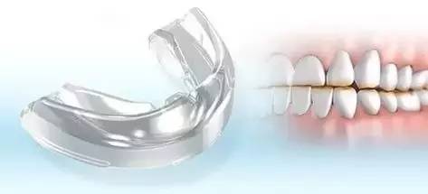 防止磨牙的牙套到底有没有用,磨牙严重牙套推荐