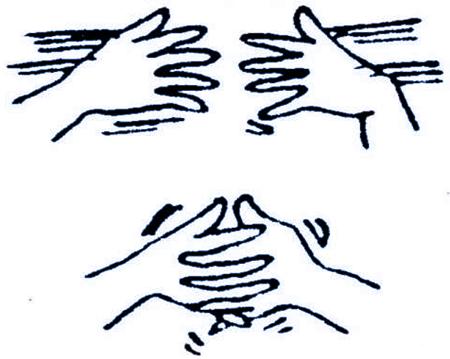 脑瘫孩子腕指关节屈曲、拇指内收训练