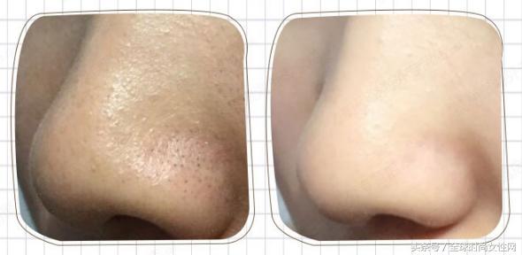 控油毛孔粗撕拉面膜,清洁撕拉面膜去闭口收缩毛孔