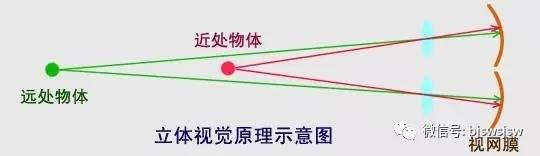 儿童弱视缺乏立体视觉,单眼弱视怎样训练双眼立体感呢