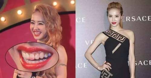 用完口红嘴唇起死皮怎么救,口红粘牙齿什么原因