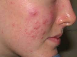 基础护肤的正确步骤油性皮肤,基础护肤的正确的全部步骤