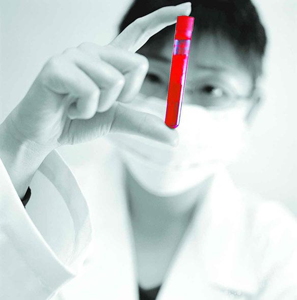 白细胞减少已经10年了应该怎么办,不明原因的白细胞减少能治好吗