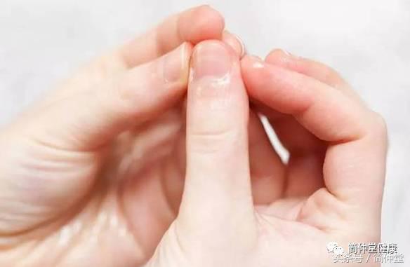 手夏天开裂和起皮是什么原因,夏天嘴皮干燥起皮怎么办