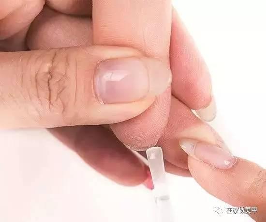 玛蒂被折断手指,玛蒂折断手指