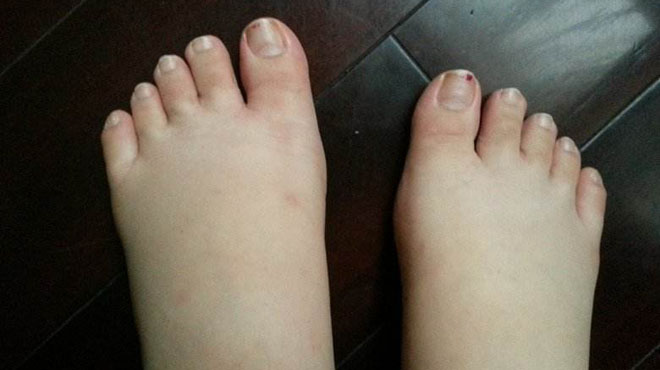 脚部肾的反射区疼是怎么回事,肾好不好脚部有什么症状