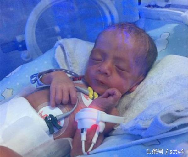 成都妈妈诞下同卵三胞胎5天准备了12包尿不湿